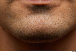 HD face Skin Juan Andino chin face skin pores skin…